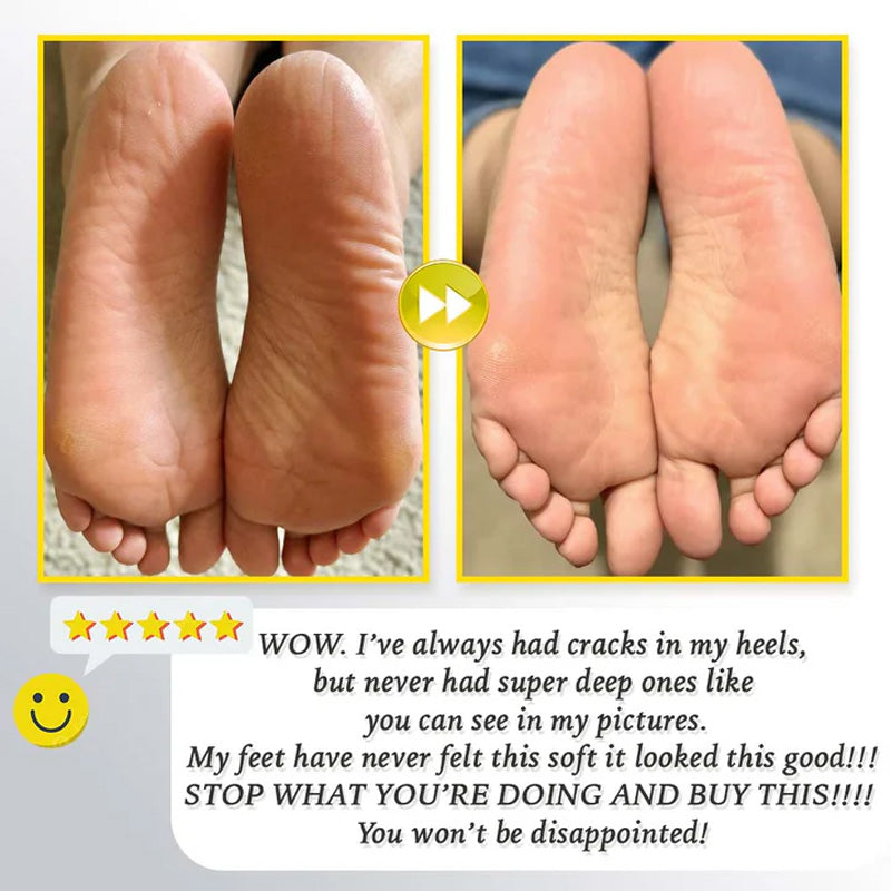 מקרצף רגליים חשמלי נטען