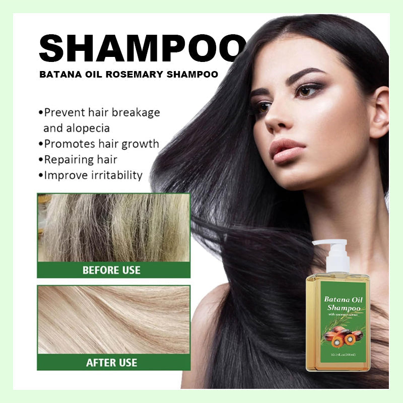 💖✨שמפו רוזמרין שמן בטנה