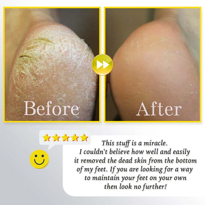 מקרצף רגליים חשמלי נטען