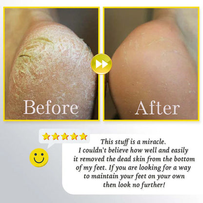 מקרצף רגליים חשמלי נטען