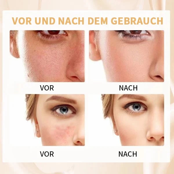 🏆קנה 1, קבל 1 בחינם🎉הבסיס הטוב ביותר לשינוי צבע לעור בוגר