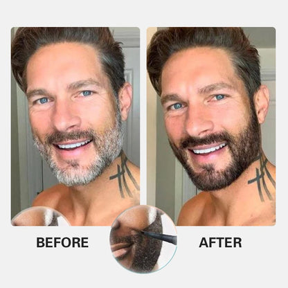 עט רב בשימוש 4 נקודות